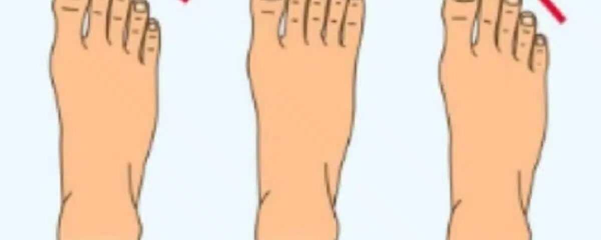 La forme de vos pieds et ce qu’elle révèle sur votre personnalité